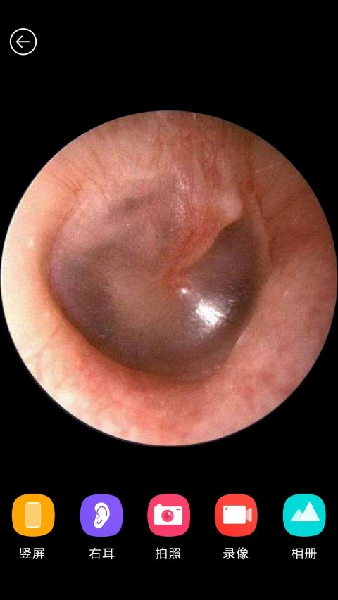 蜂鸟采耳app 蜂鸟采耳app官方下载